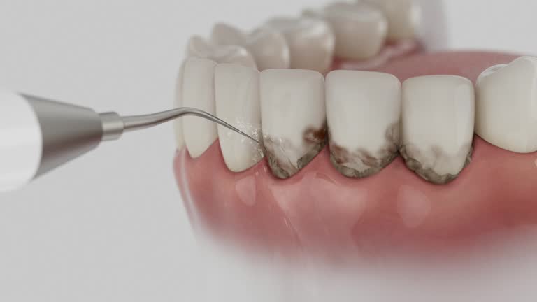 Trusted Dental Crowns And Bridges service in Sunbury, OH - Dentist Open Now